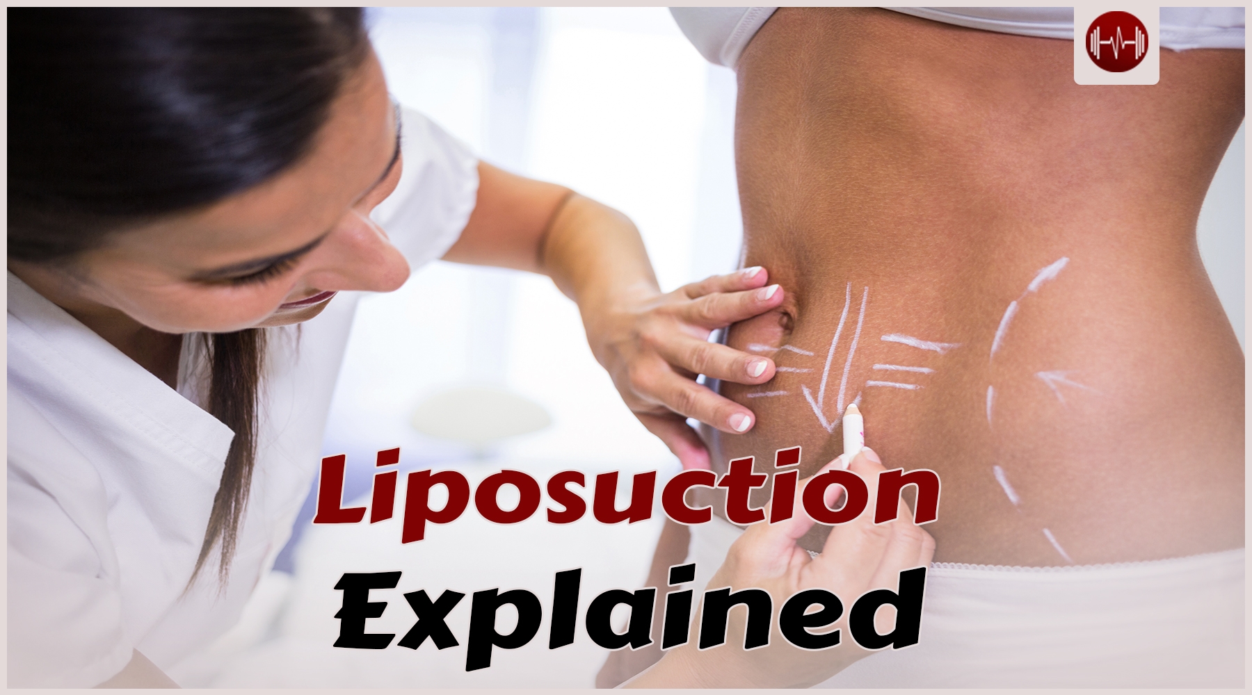 Liposuction: A quick and easy solution for stubborn fatty areas