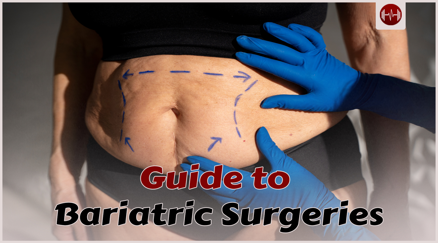 Complete Guide to Bariatric Surgery Costs & Outcomes